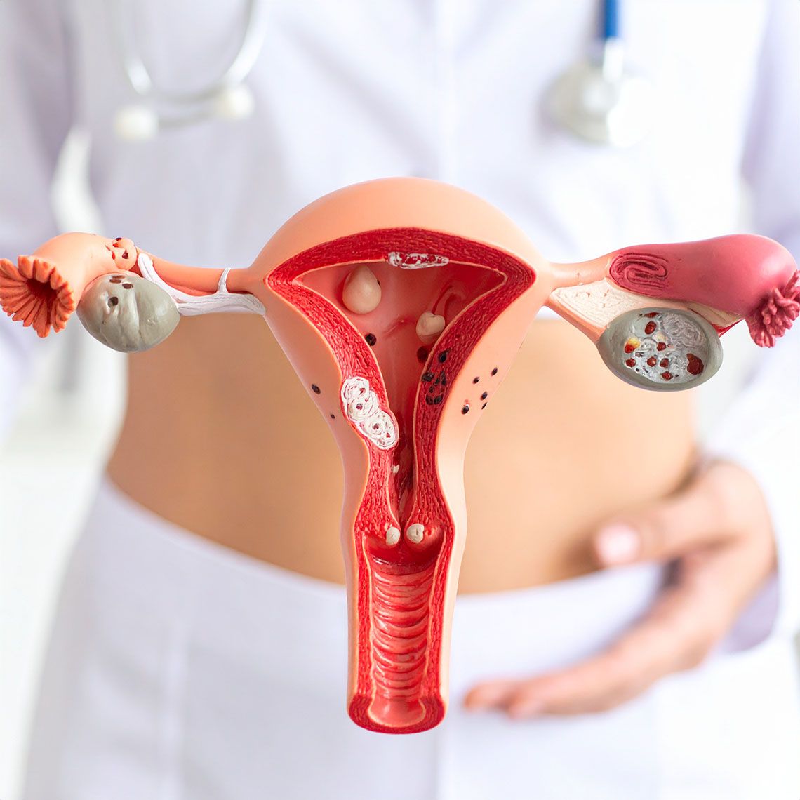 Centrum komplexní léčby endometriózy